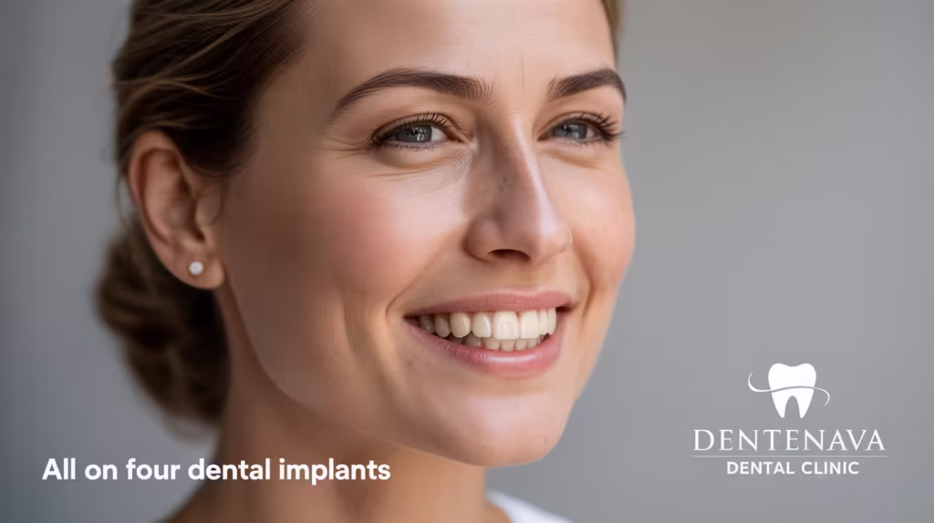 All on Four Dental Implants Cost: A Clear and Honest Breakdown 1 all on four dental implants cost