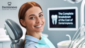 cost of dental implants