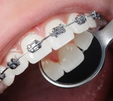Orthodontics Orthodontics