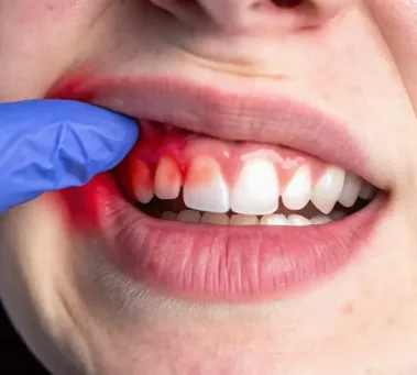Periodontics Periodontics